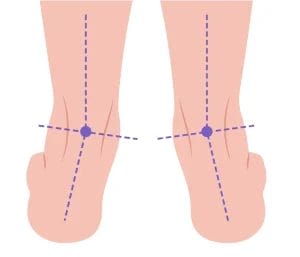 pronation